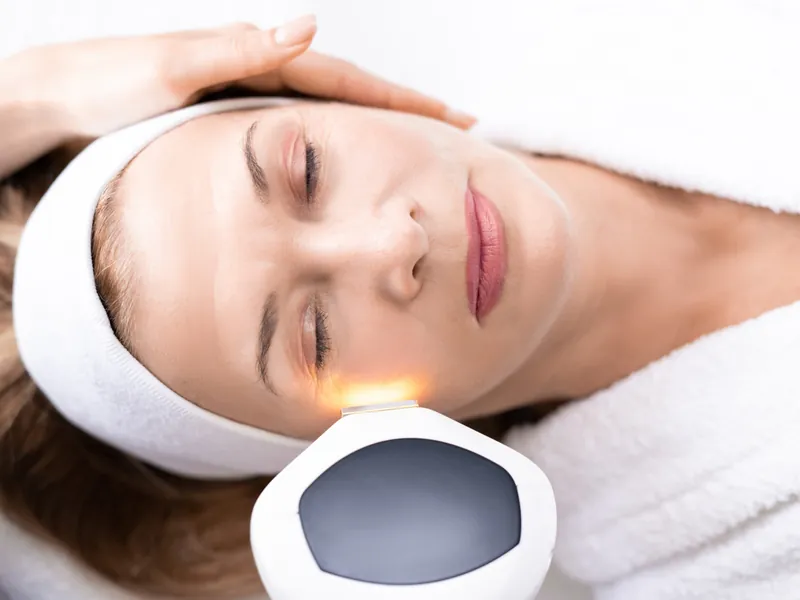 Sessão de Fotorejuvenescimento com Luz Intensa Pulsada
